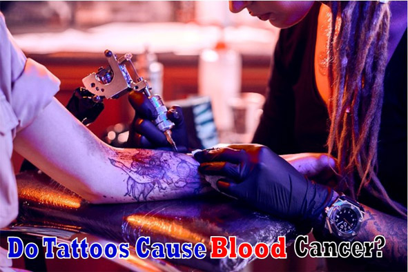 Do Tattoos Cause Blood Cancer-