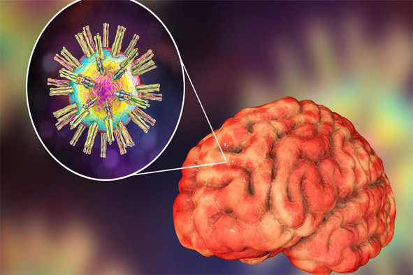 The Cold Sore Virus - Your Brain’s Secret Invader